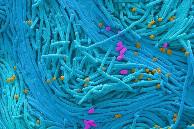 人类微生物组计划第二阶段成果重磅发布 揭示微生物对健康影响 麻省理工科技评论 中文网